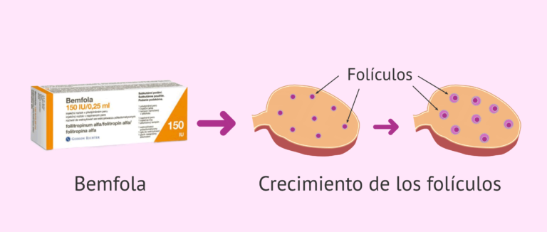 Bemfola 150 UI/0,25 ml: Solución inyectable en pluma precargada – Pros y características