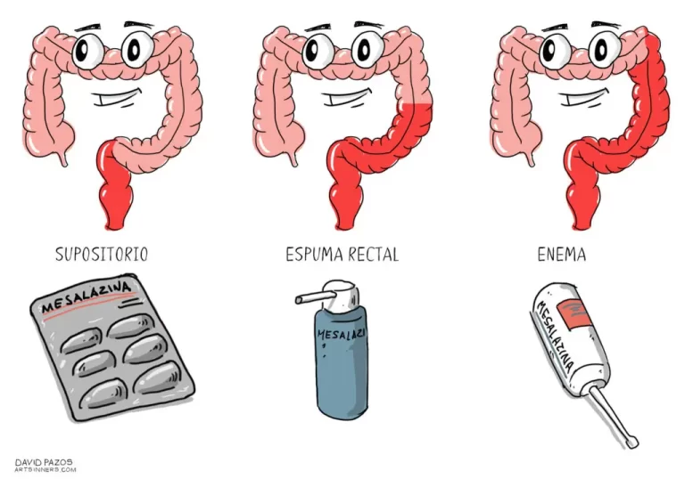 Claversal Espuma Rectal: ¿Efectivo tratamiento para la diarrea con espuma?