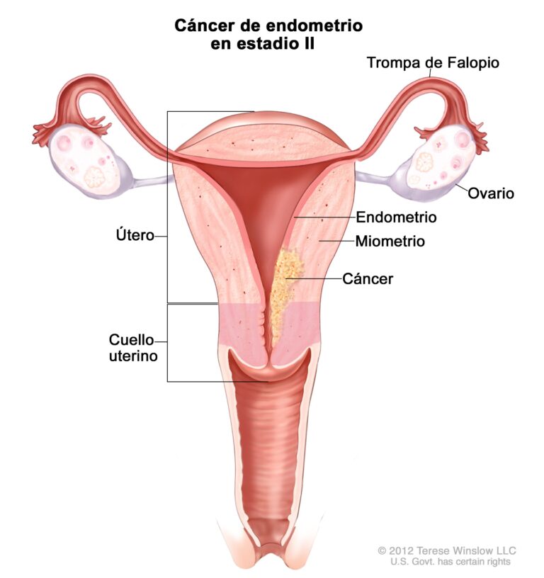 Endometritis crónica tratamiento: Ficha técnica de Keytruda 25 mg/ml concentrado para solución para perfusión