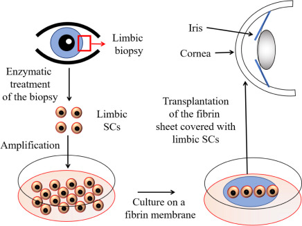 Ficha técnica de Holoclar: Skyrocket tu visión con células del ojo vivas