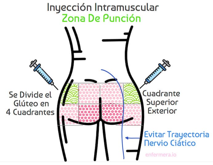 Inyección intramuscular en el glúteo: Ficha técnica de AKIS 50 mg – Solución inyectable en jeringa precargada