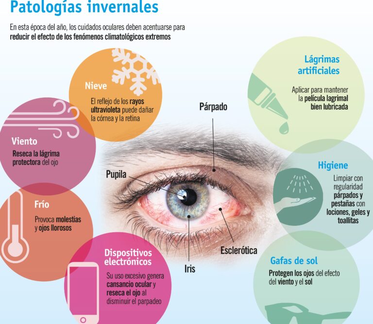 Síntomas del ojo seco: descubre las señales y cómo aliviarlos